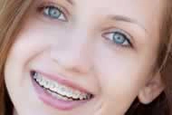 Smiling teenage girl with dental braces showing a happy, confident smile.
